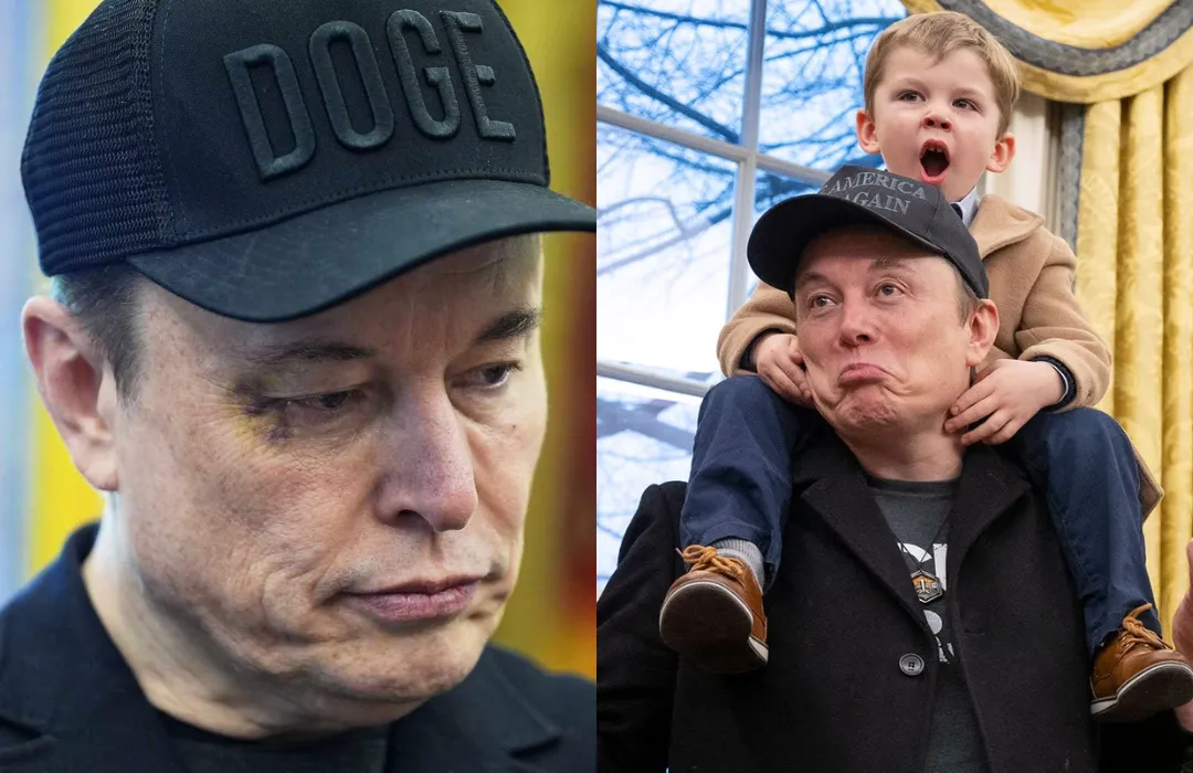 Elon Musk Blames 4-Year-Old Son for Black Eye During White House Farewell