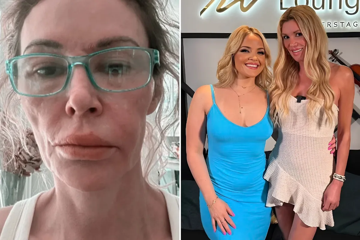 Brandi Glanville reveals shocking impact of her disfigured face on her sex life