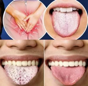 F. What Your Tongue Can Tell You About Your Health: 4 Symptoms You Shouldn’t Ignore