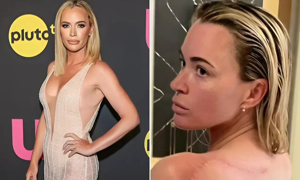 Teddi Mellencamp Opens Up About RHOBH Firing: ‘It Turned Into a Nothing Burger’ trucc
