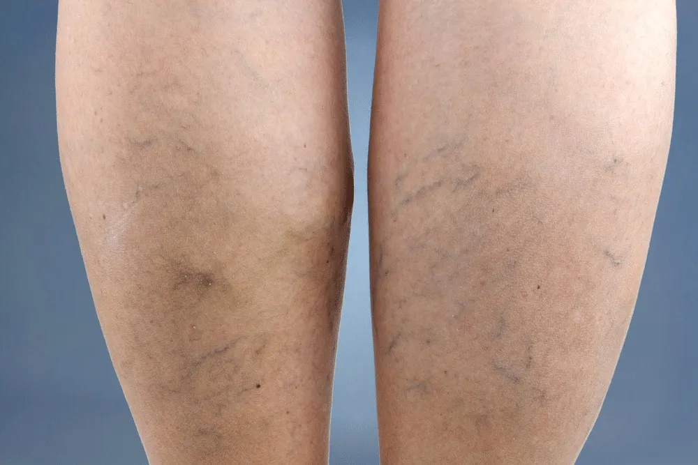 4. If you see these points on your feet, it means you have…