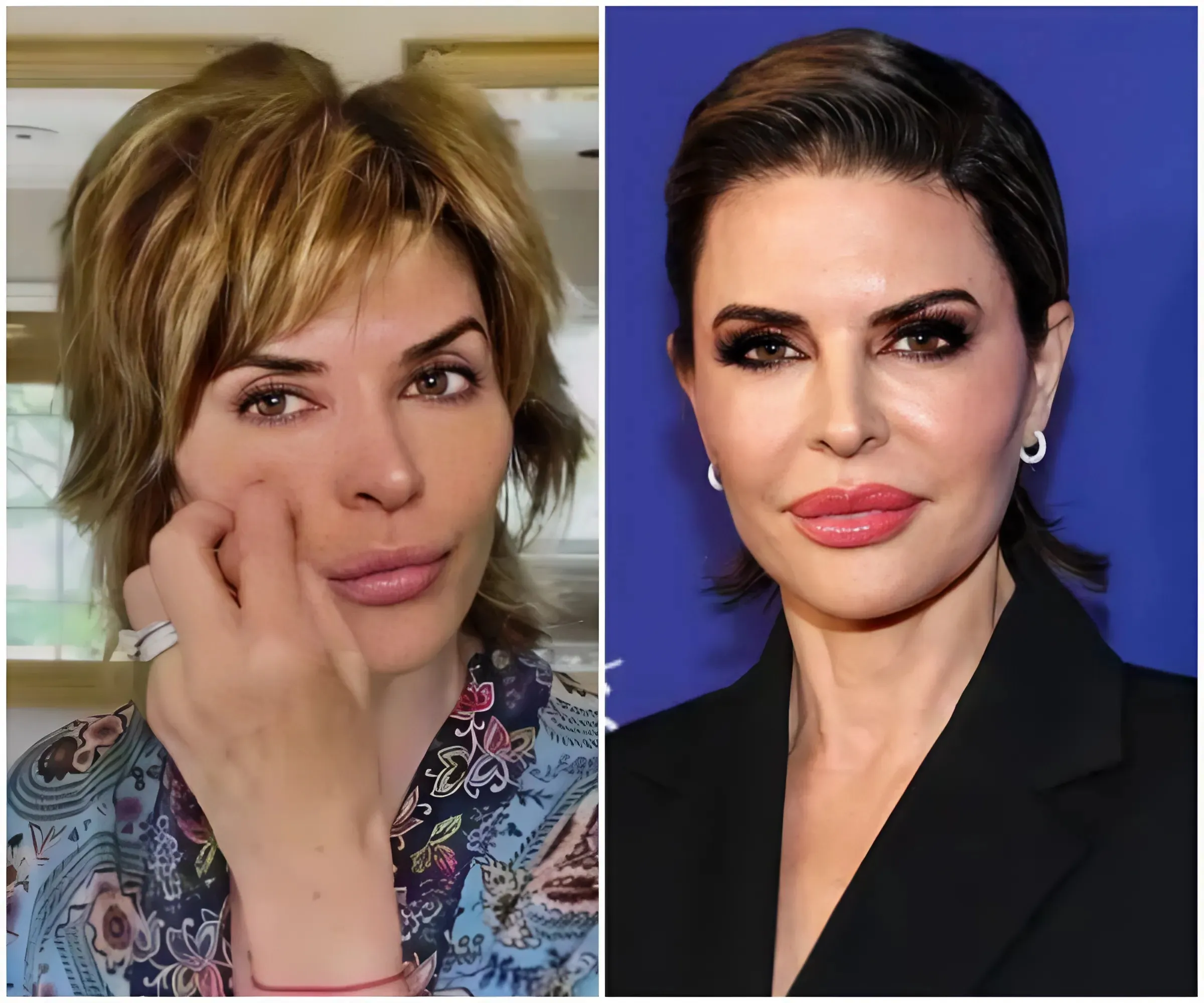 Lisa Rinna caught up in multimillion-dollar illegal filler scandal: once received over $500,000 in cash to promote unlicensed beauty salon – now facing federal investigation!