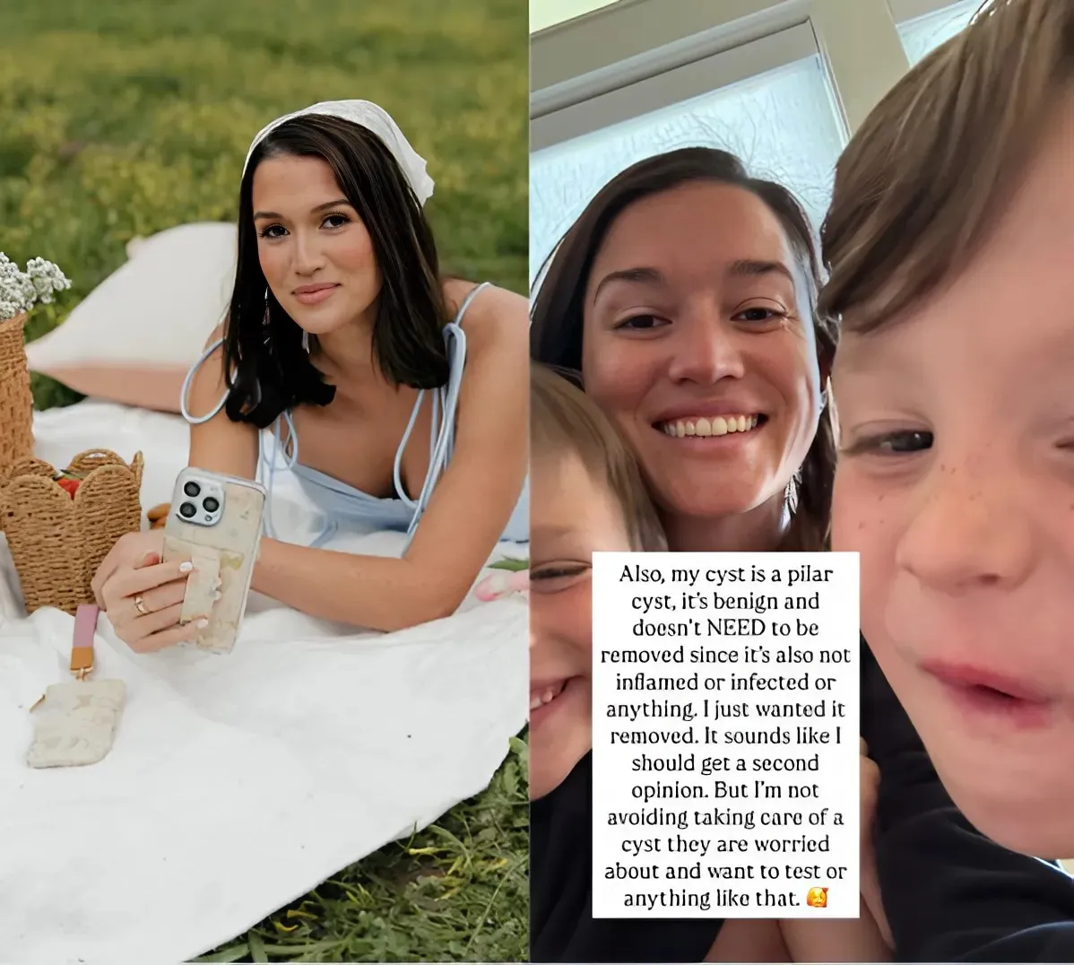 Jade Roper Tolbert Discusses Her Pilar Cyst and Potentially Having to Shave Part of Her Head Jade Roper Tolbert Discusses Her Pilar Cyst and Potentially Having to Shave Part of Her Head