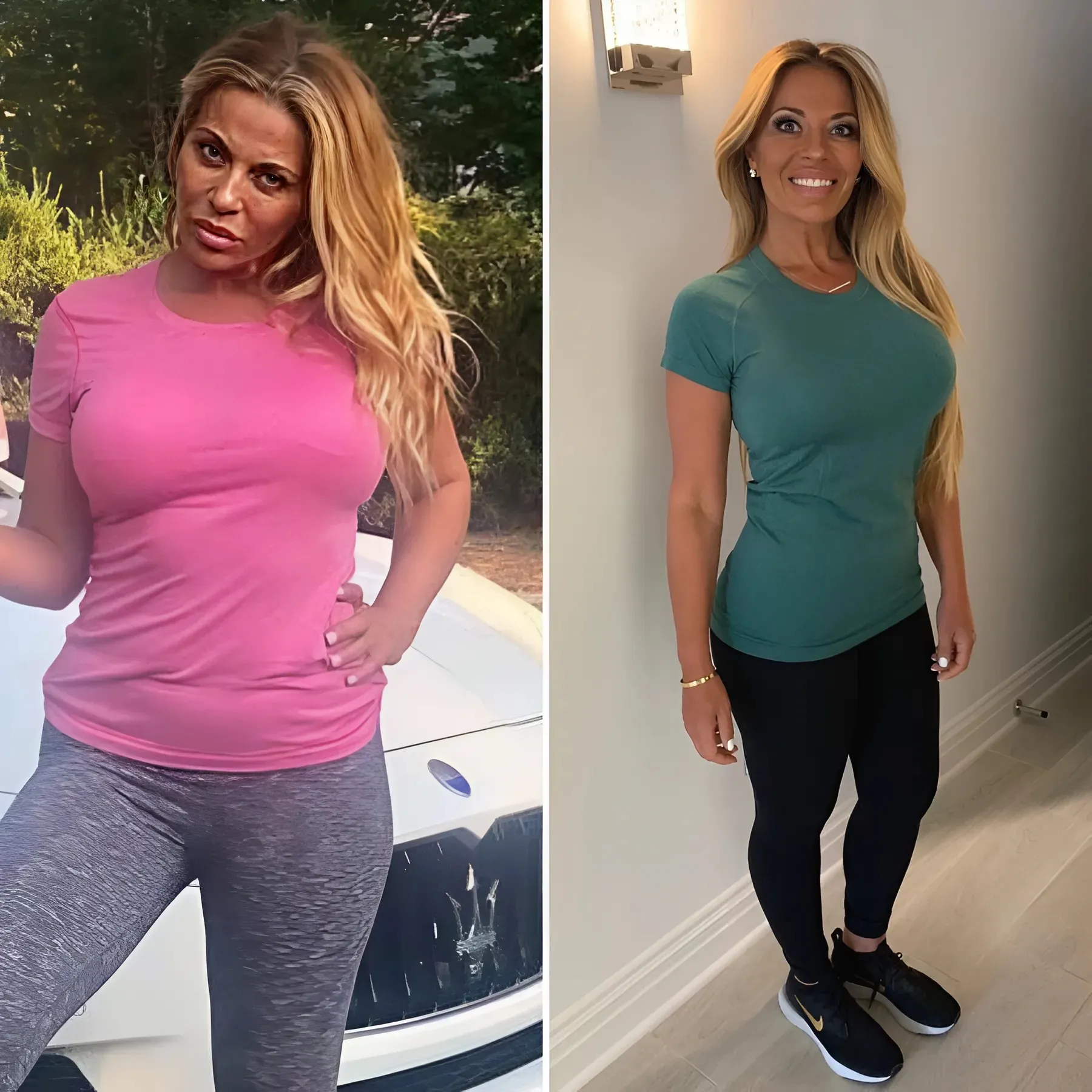 Dolores Catania Opens Up About Health Struggles: Weight Gain and Heart Procedure Amid Mounjaro Challenges