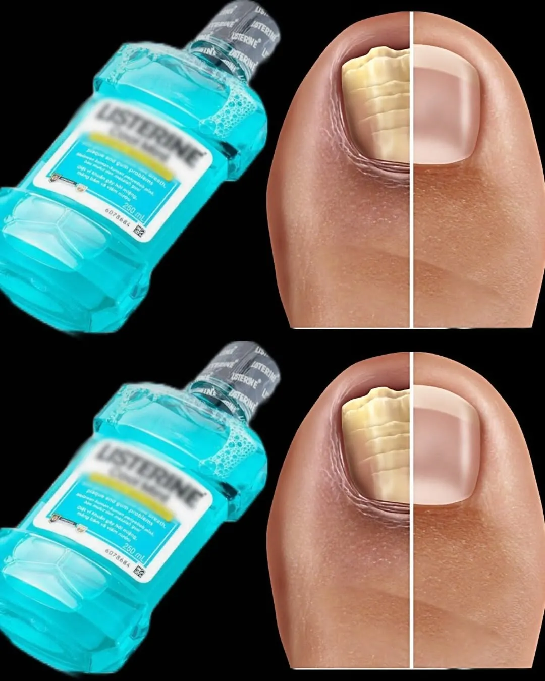 4. Say Goodbye to Nail Fungus with This Simple Home Remedy