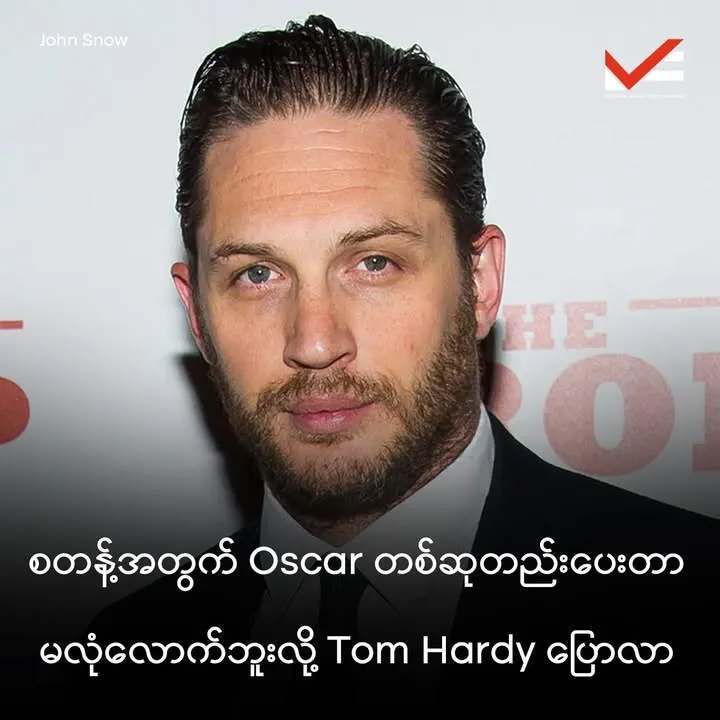 Tom Hardy