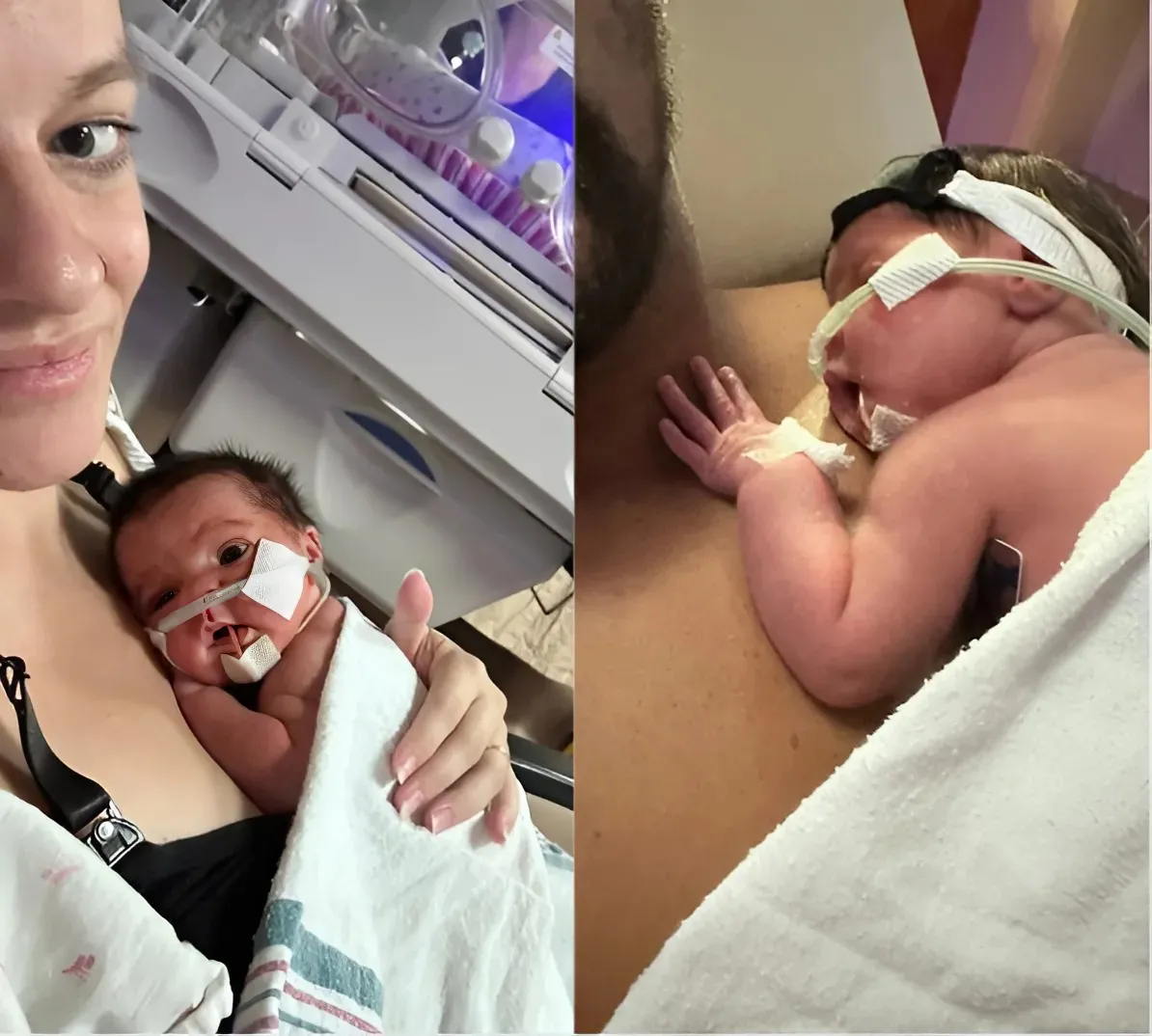 A Milestone Moment in the NICU: Mackenzie’s Journey, Day 4