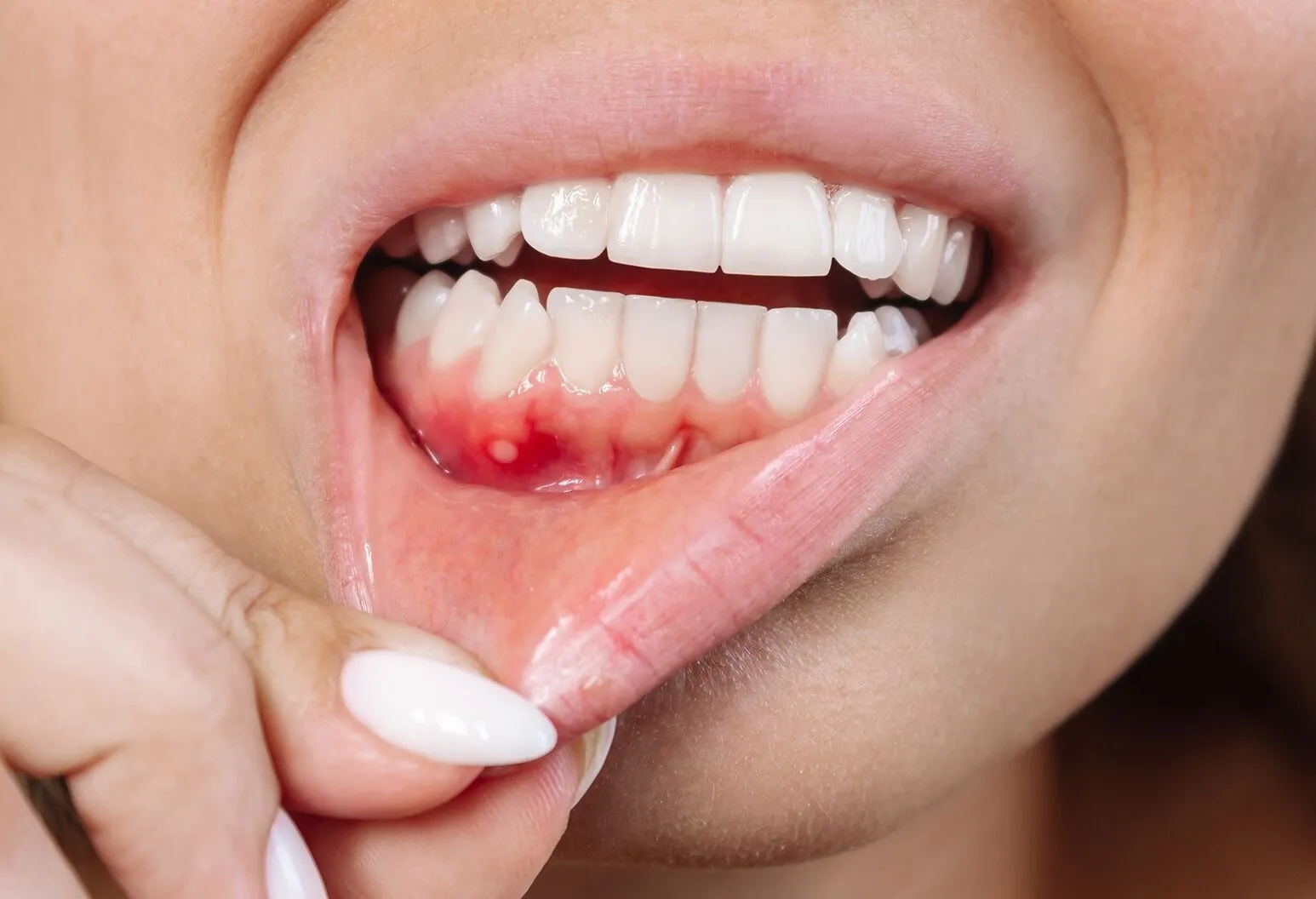 4. Don’t Underestimate It: Recognizing the Early Signs of Oral Can...