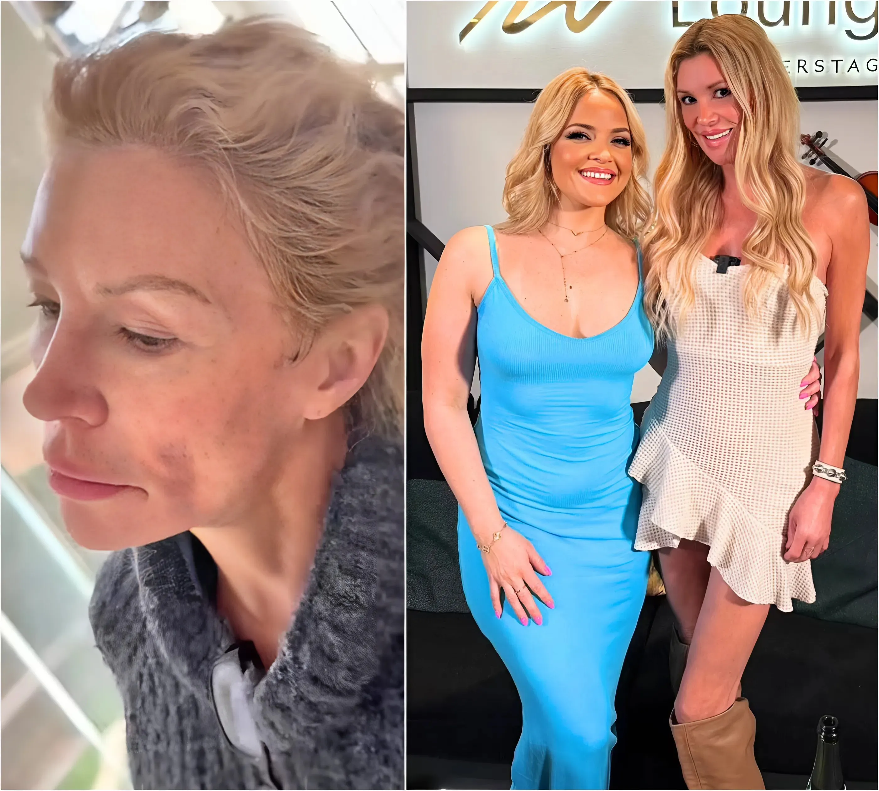 Brandi Glanville reveals shocking impact of her disfigured face on her sex life