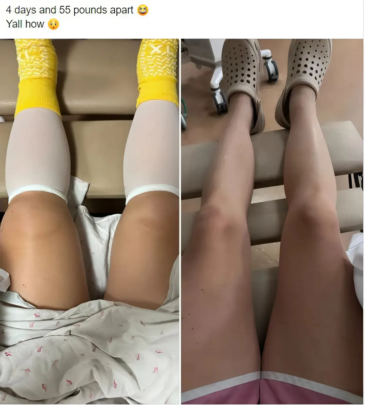 ‘Teen Mom’ MacKenzie McKee Shares 55-Lb Weight Loss In 4 Days, Pics