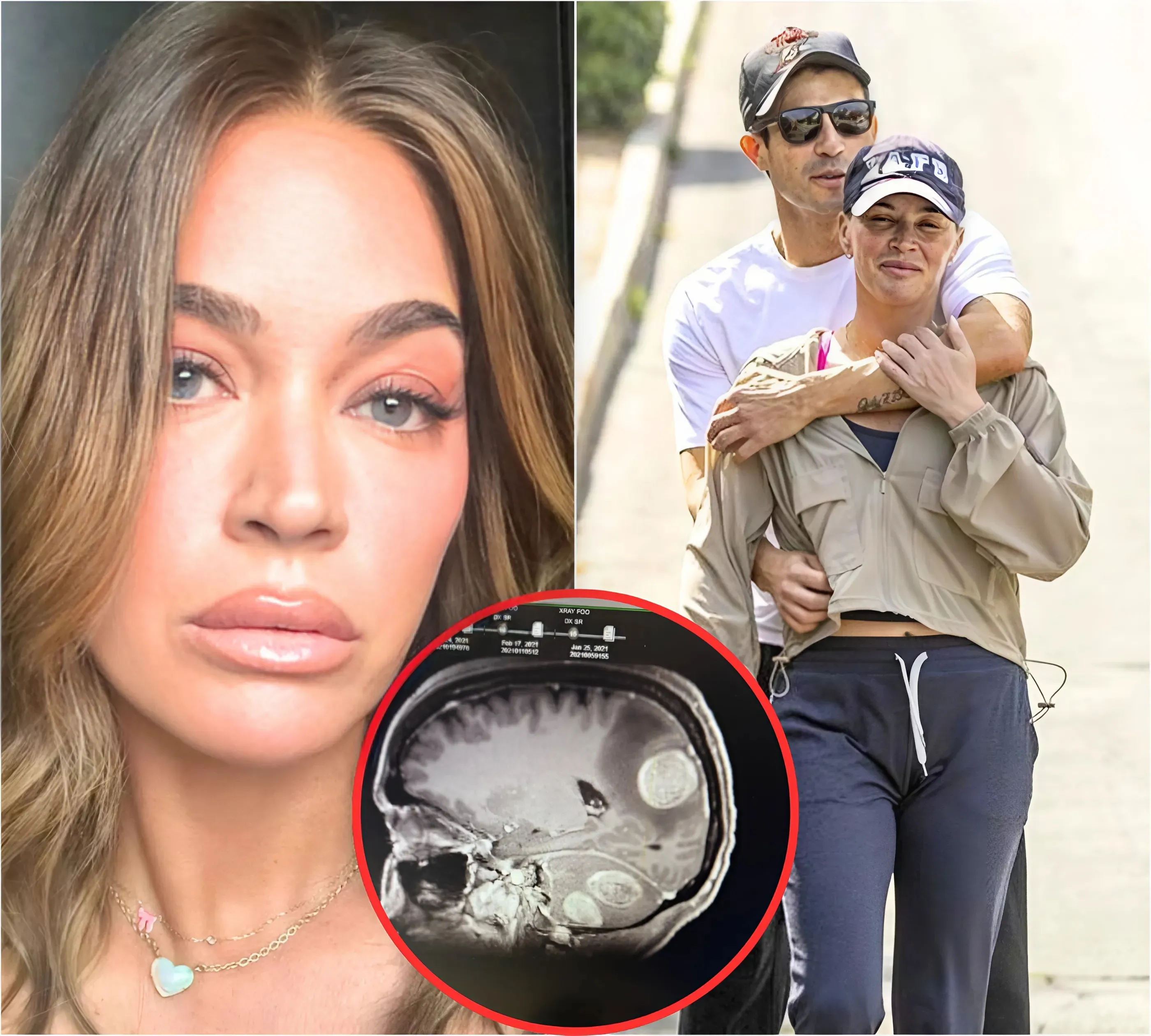 Teddi Mellencamp Shares Results of Her Recent MRI Amid Her Stage 4 Cancer Battle, Plus Addresses Dating Backlash