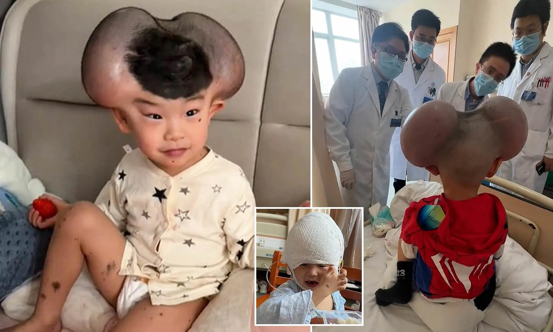 Boy once mocked and called “Mickey Mouse” – see him today
