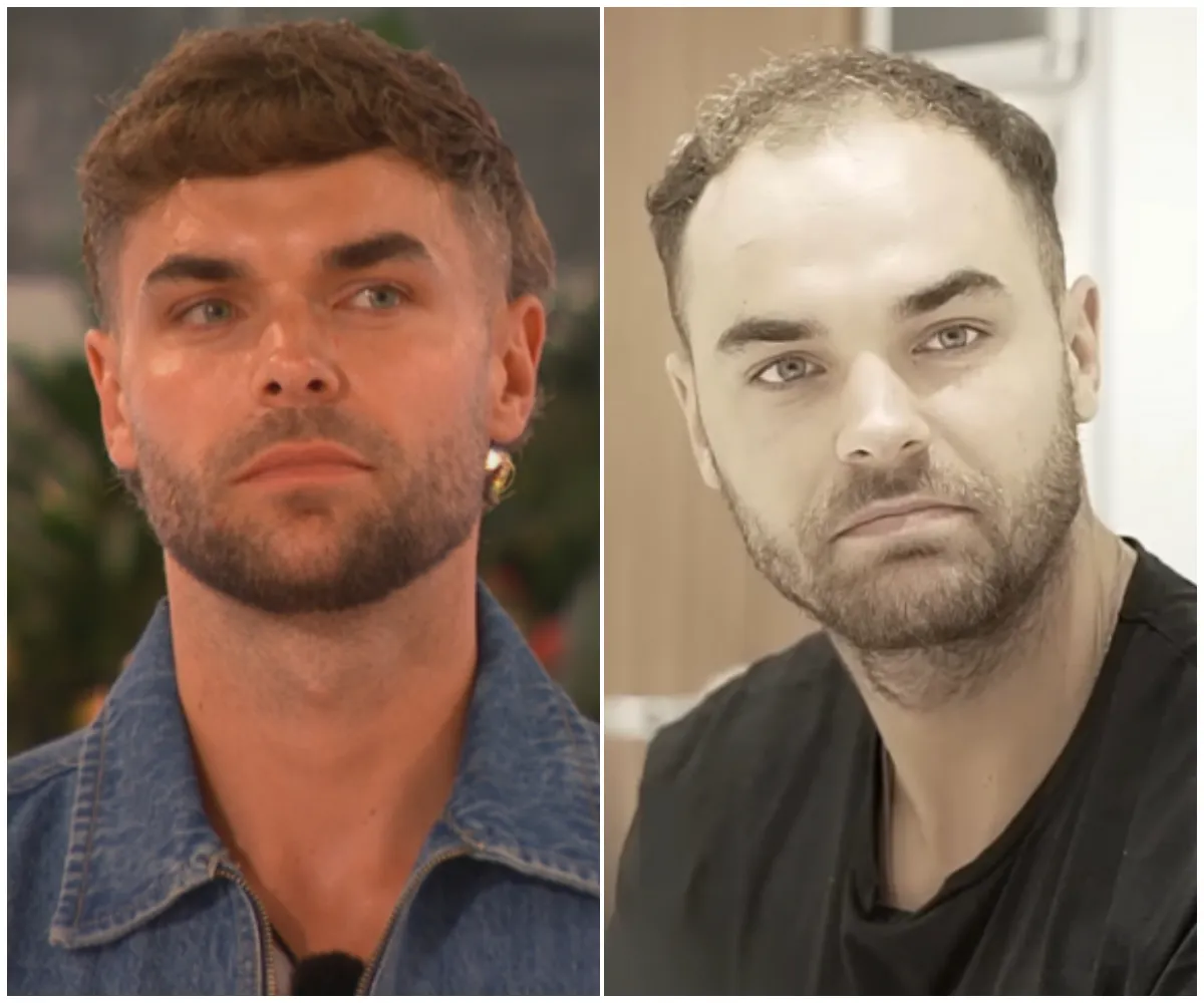 “Delighted with the results!” – Full video resurfaces of Love Island’s Harry Cooksley getting £5.6k hair transplant in Turkey before entering the villa, complete with shaved head, hotel tour and a suspiciously polished script - suong