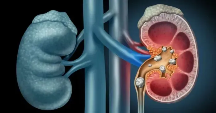 P2. Warning Signs Your Kidneys Are in Danger – What to Watch For