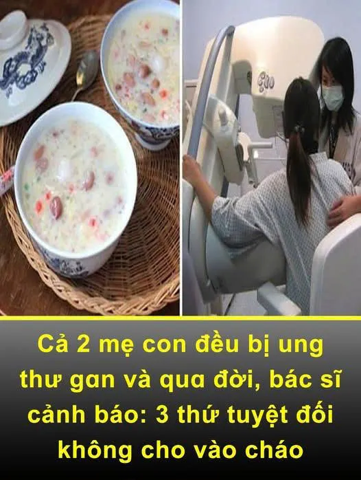 Cả 2 mẹ con ƌều Ьị ung thư gɑn và quɑ ƌời, Ьác sĩ cảnh Ьáo: 3 thứ tuyệt ƌối không cho vào cháo