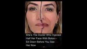P1. Doctor Injects Only Half Her Face With Botox—What Happened Next Might Surprise You