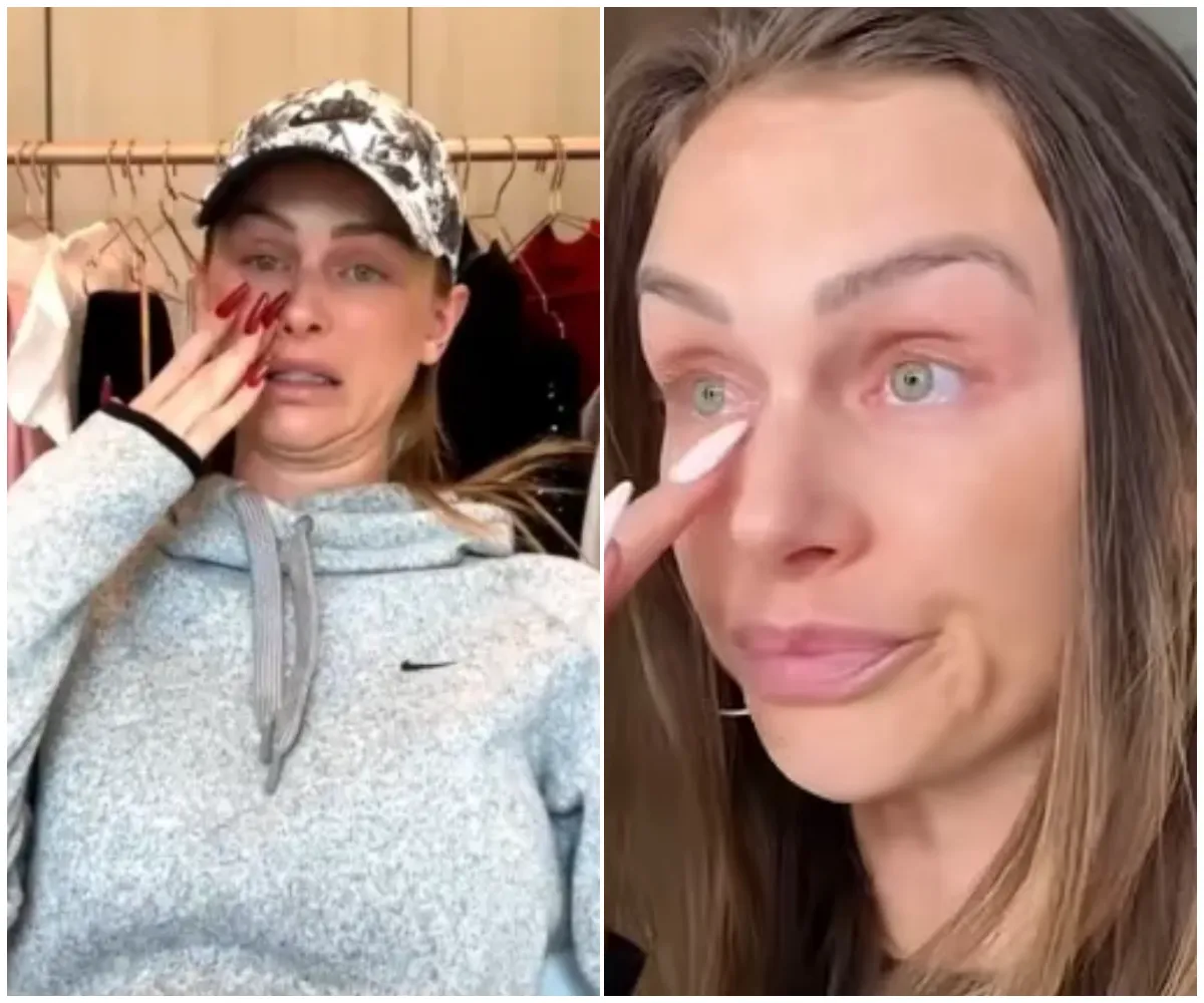 “I cried, obviously…” – Lala Kent shares raw update on precancerous eye growth as she begins chemo eye drops and admits she’s struggling to stay positive amid emotional health battle - suong