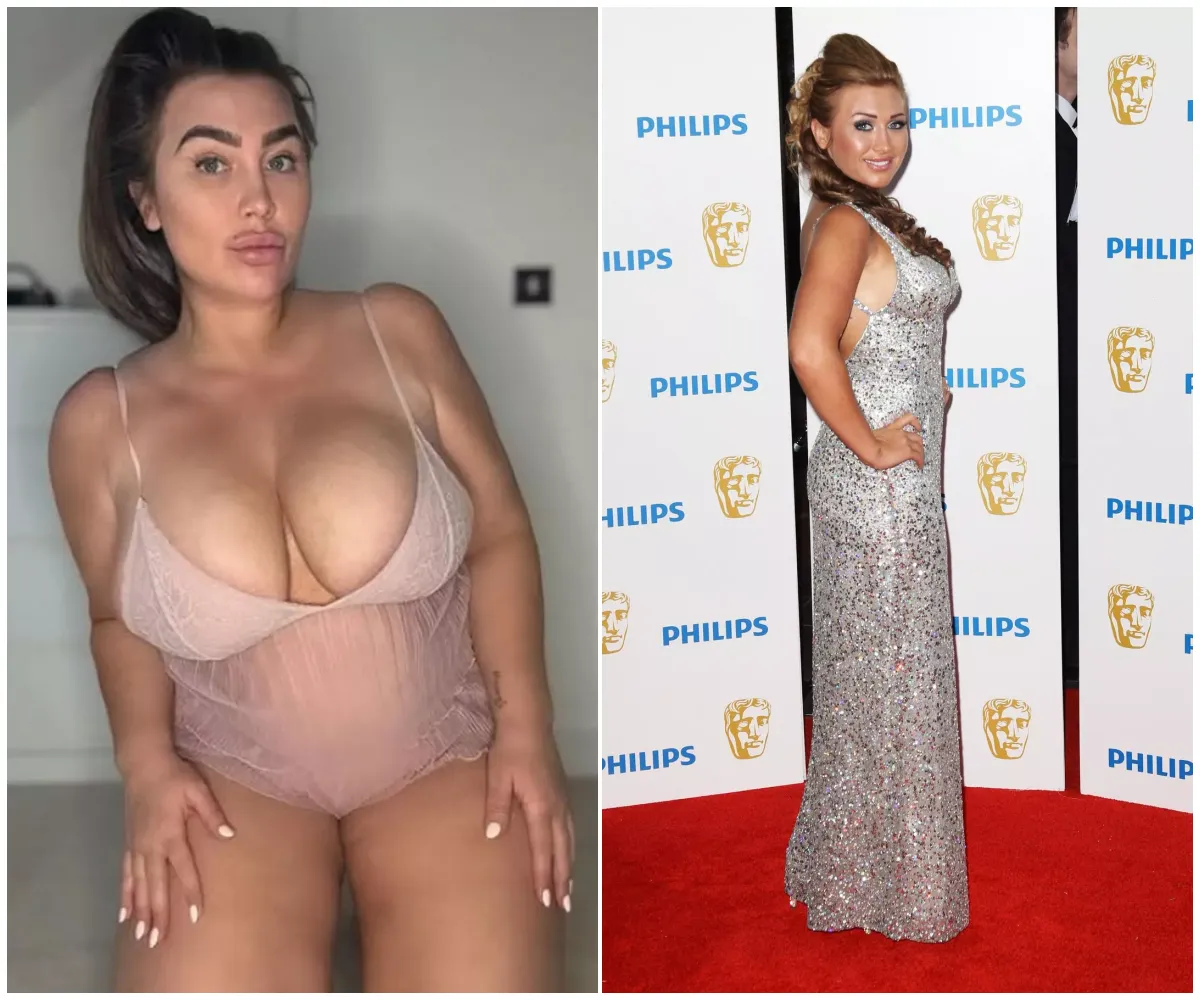 “I’ve ruined my looks with surgery” – Lauren Goodger admits devastating BBL regret as she unveils dramatic transformation 15 years after TOWIE debut and begins emotional journey to reclaim her natural body - suong “I’ve ruined my looks with surgery” – Lauren Goodger admits devastating BBL regret as she unveils dramatic transformation 15 years after TOWIE debut and begins emotional journey to reclaim her natural body - suong