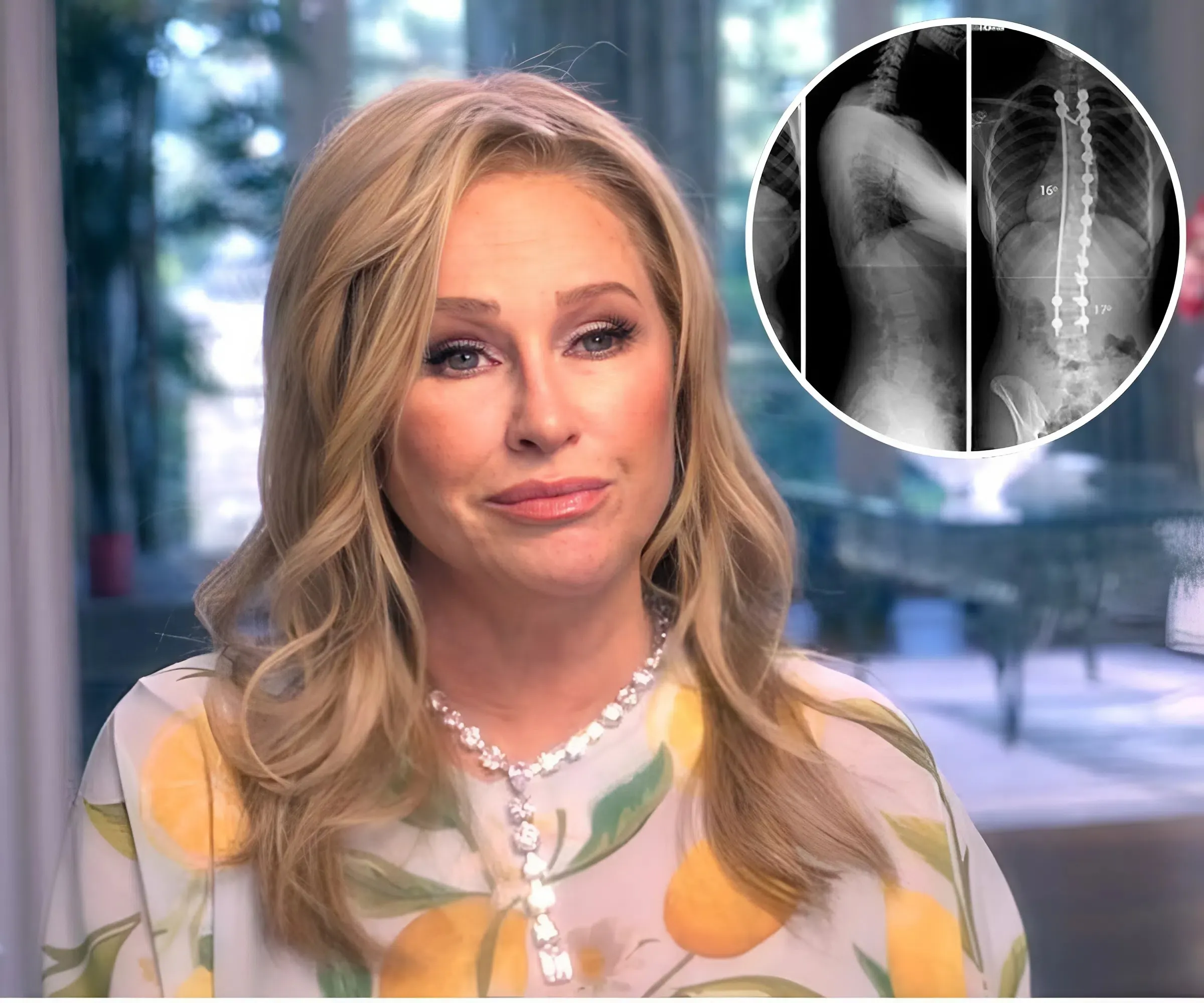 "Kathy Hilton Shocks With Series Of Film Photos: Revealing The Secret Disease That Tormented Her Every Day And The Tearful Battle With Endless Pain!"