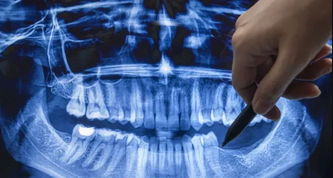 First-Ever ‘Tooth Regrowth’ Drug Set to Enter Human Clinical Trial Phase