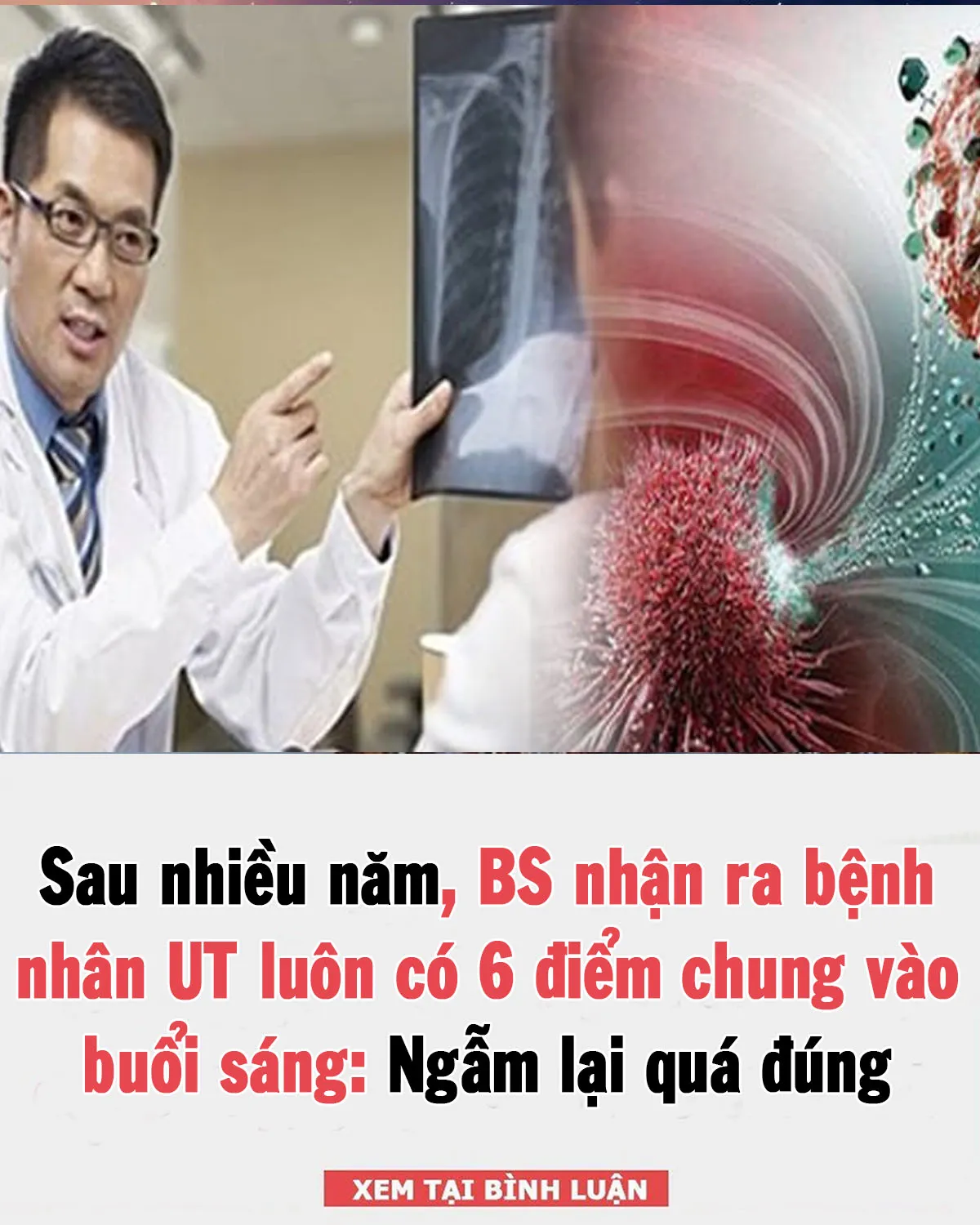 Sau nhiều năm, BS nhận ra bệnh nhân UT luôn có 6 điểm chung vào buổi sáng: Ngẫm lại quá đúng