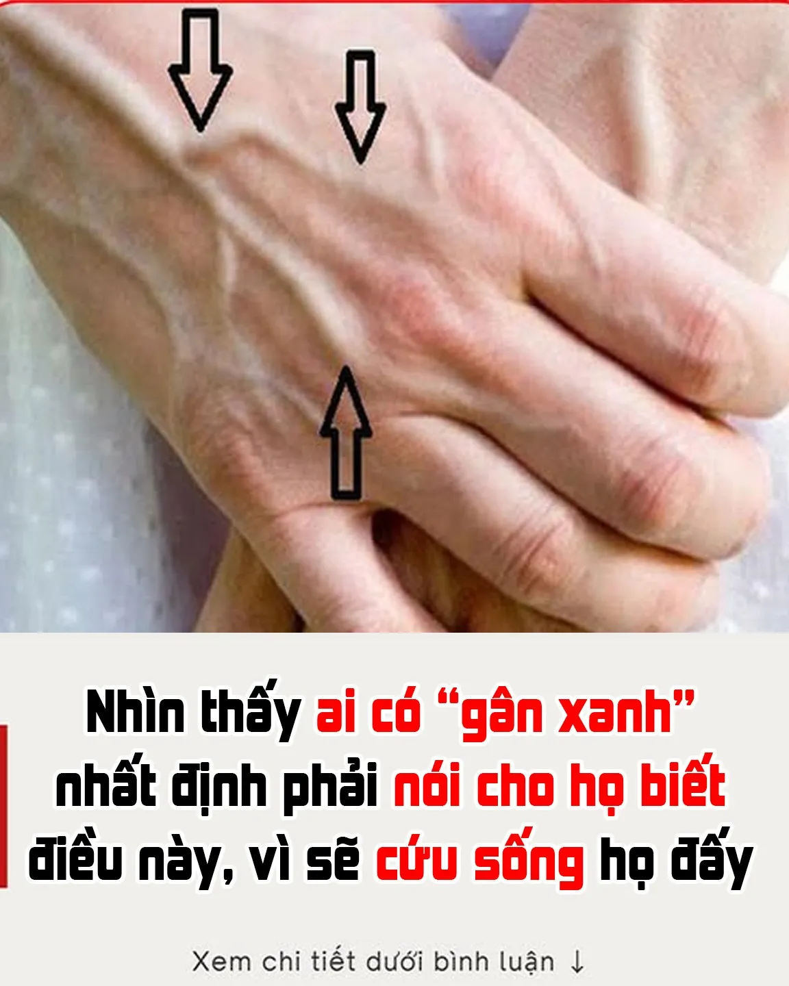 Nhìn thấy ai có “gân xanh” nhất định phải nói cho họ biết điều này, vì sẽ cứu sống họ đấy Nhìn thấy ai có “gân xanh” nhất định phải nói cho họ biết điều này, vì sẽ cứu sống họ đấy