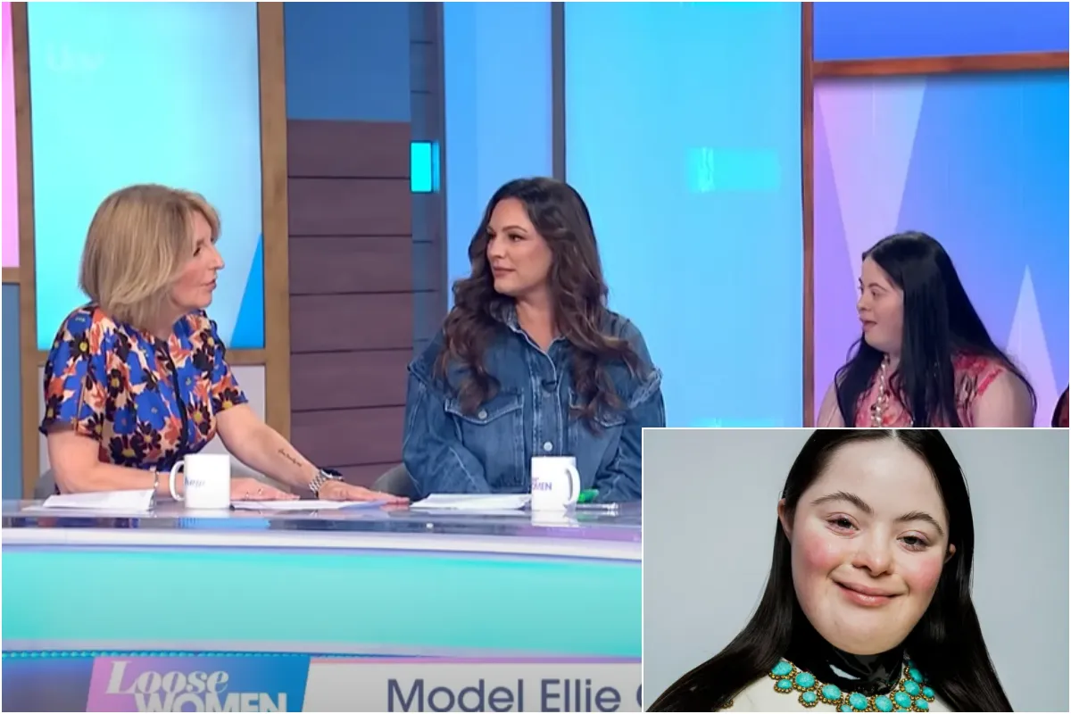 Breaking Barriers: Ellie Goldstein Becomes the First Model with Down Syndrome to Grace Vogue’s Cover trucc