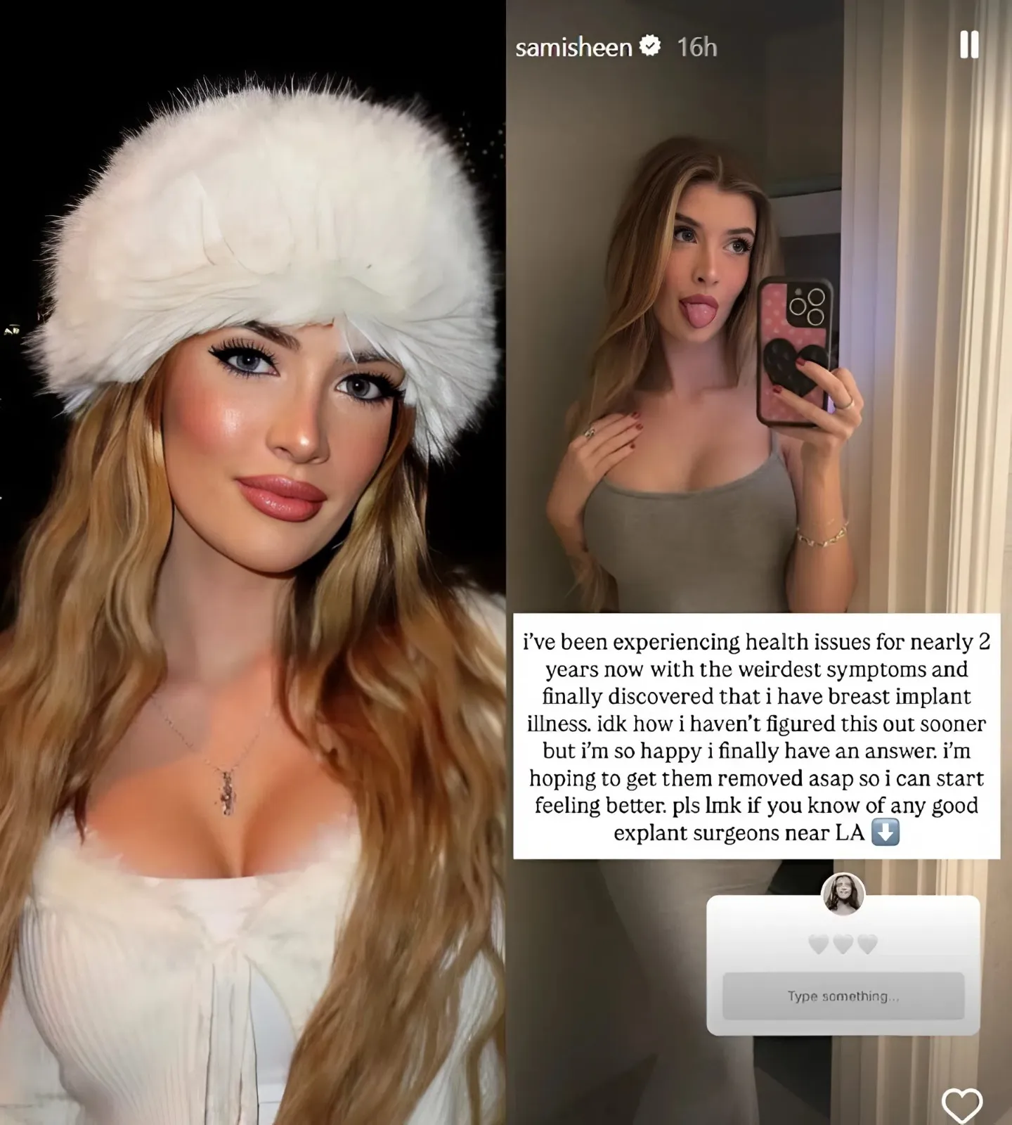 Sami Sheen Reveals She’s Having Breast Implants Removed After Years of Health Struggles as She Explains Symptoms