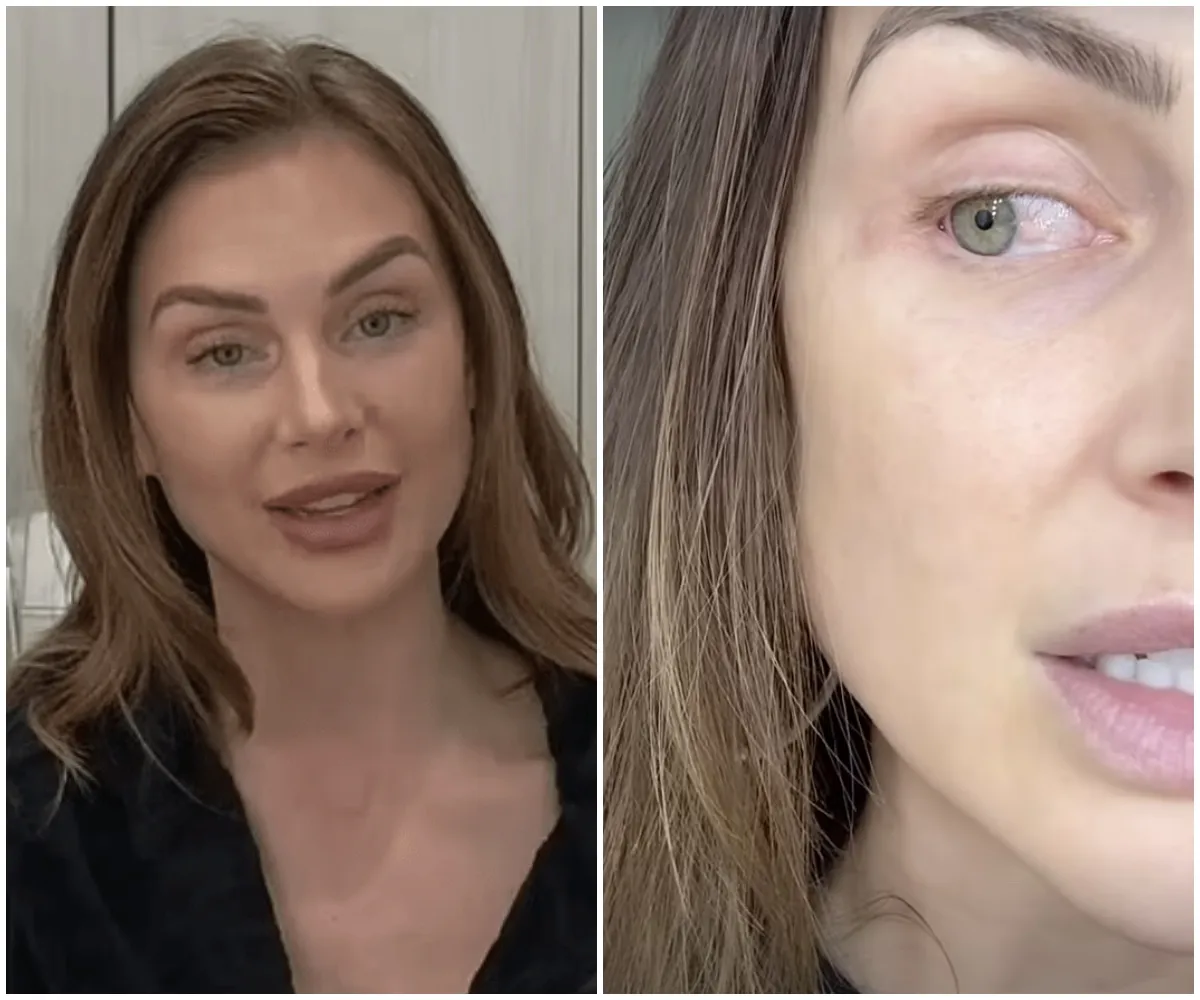 "Lala Kent Shocks With Latest Health Update: Eye Tumor Removed But Cancer Still Haunts – Decides To Temporarily Quit Social Media To Focus On Recovery"