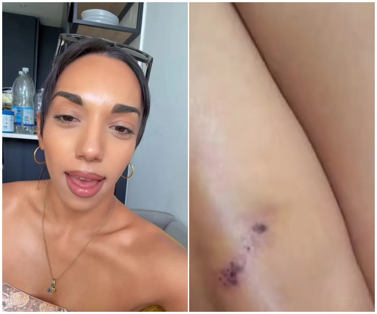 Strictly star mugged in Central London AND in broad daylight as 'traumatic' ordeal leaves them 'scared and helpless' - suong