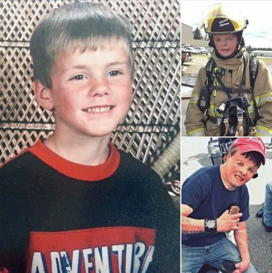 Boy Suffered Third Degree Burns at 6 Years Old and Now Becomes Firefighter Boy Suffered Third Degree Burns at 6 Years Old and Now Becomes Firefighter