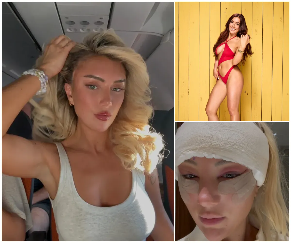 ‘What have I done?’ – Love Island’s first disabled girl Patsy Field unveils dramatic new look after flying to Turkey for cat eye surgery and reveals tragic reason behind it after show left her feeling ‘not pretty enough’ - suong