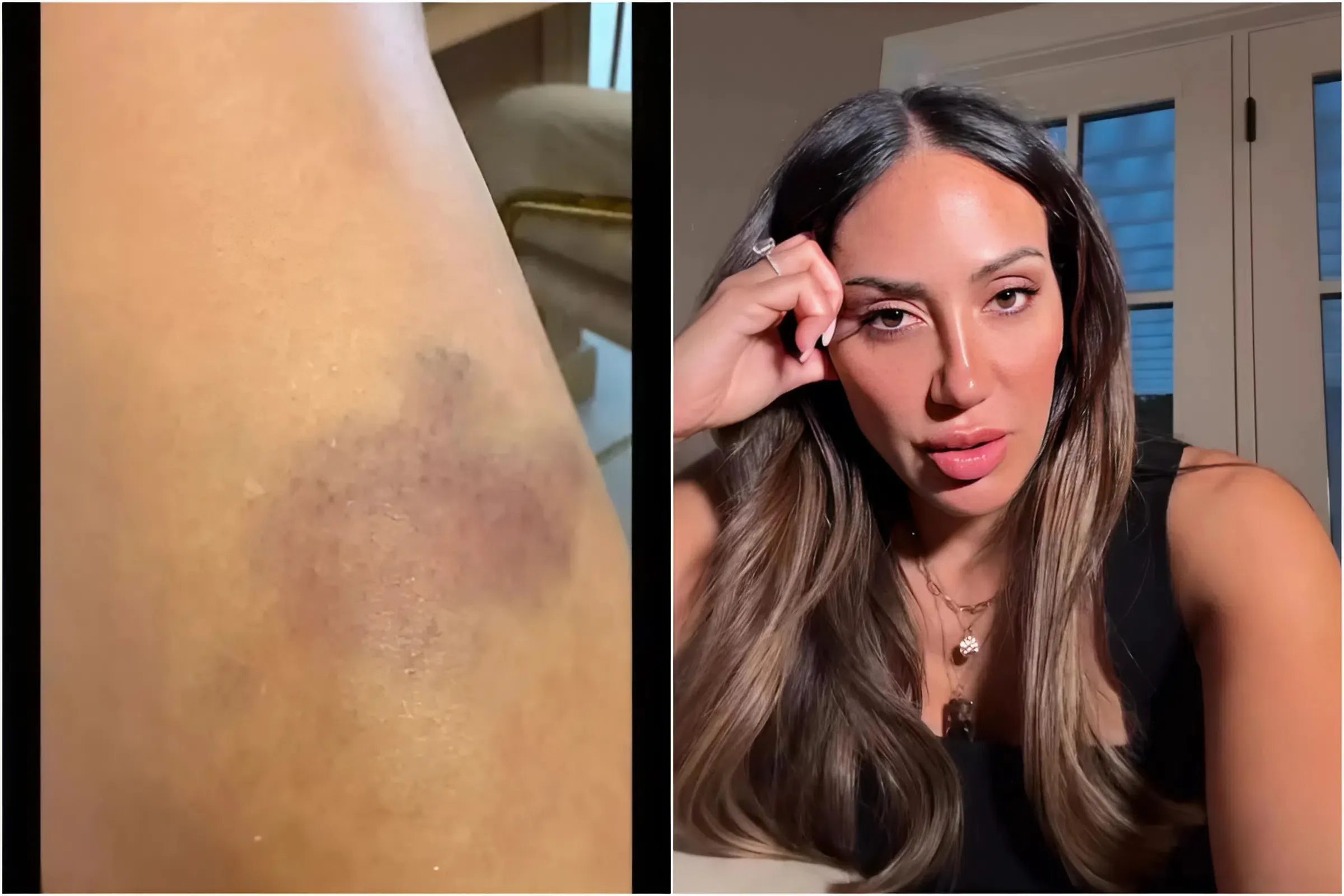 ‘Shocked and Terrified’: RHONJ Star Melissa Gorga Opens Up About ‘Serious’ Car Accident trucc