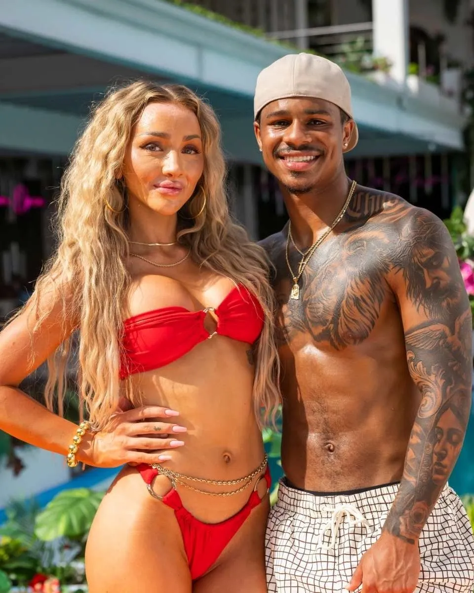 Love Island Star Vanna Einerson Responds to Backlash About Her Looks, Reveals What Work She’s Had Done and Blames Allergic Reaction, Plus She Discusses Nick and Cierra