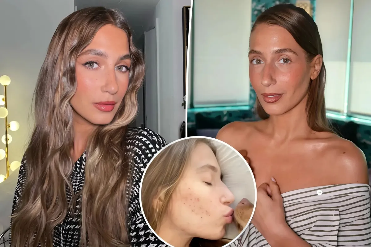 Amanda Batula's Candid Confession: Battling Acne Realities and Revealing the Remedies That Truly Made a Difference - lulu