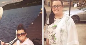 P4. Woman’s foot was swollen for years, then she finally pays the doctor a visit to learn why P4. Woman’s foot was swollen for years, then she finally pays the doctor a visit to learn why