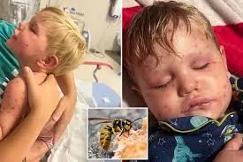 2-year-old Georgia toddler stung more than 150 times by yellowjackets
