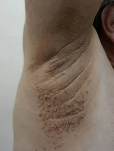 F. These are the first symptoms of cr…See more F. These are the first symptoms of cr…See more