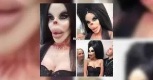 P3. Is This a 68-Year-Old Human ‘Barbie Doll’ After Botched Plastic Surgeries? - Improve your life