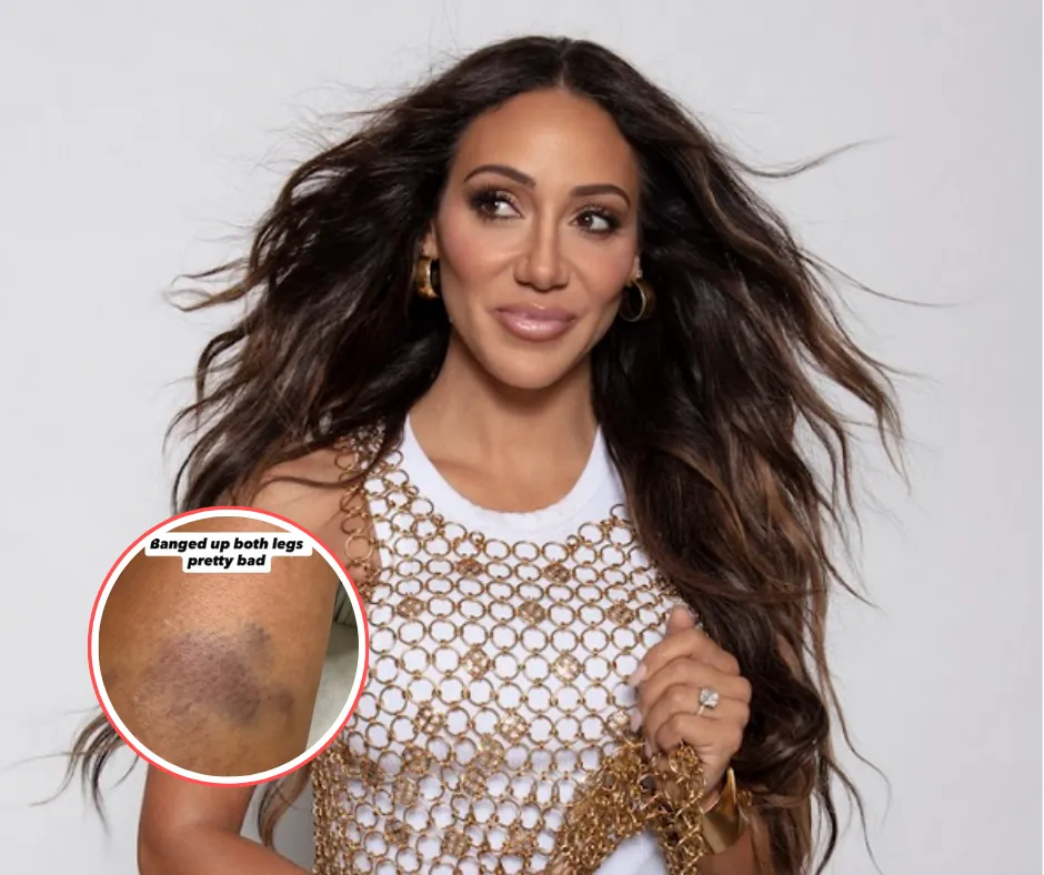 'RHONJ' Star Melissa Gorga Was in a 'Serious' Car Accident