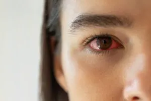 F.  The Real Consequences of Sleeping With...