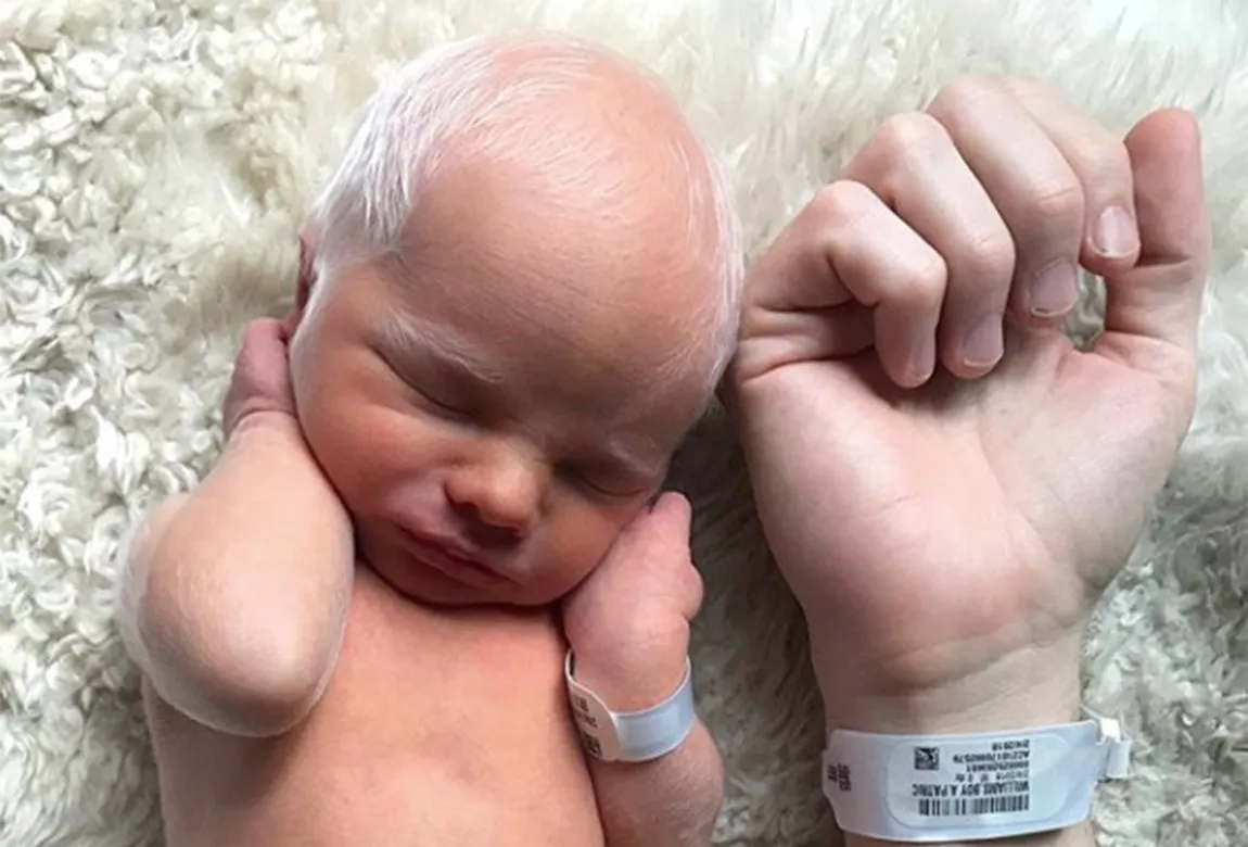 Albino baby mocked for white hair is happy and healthy years later