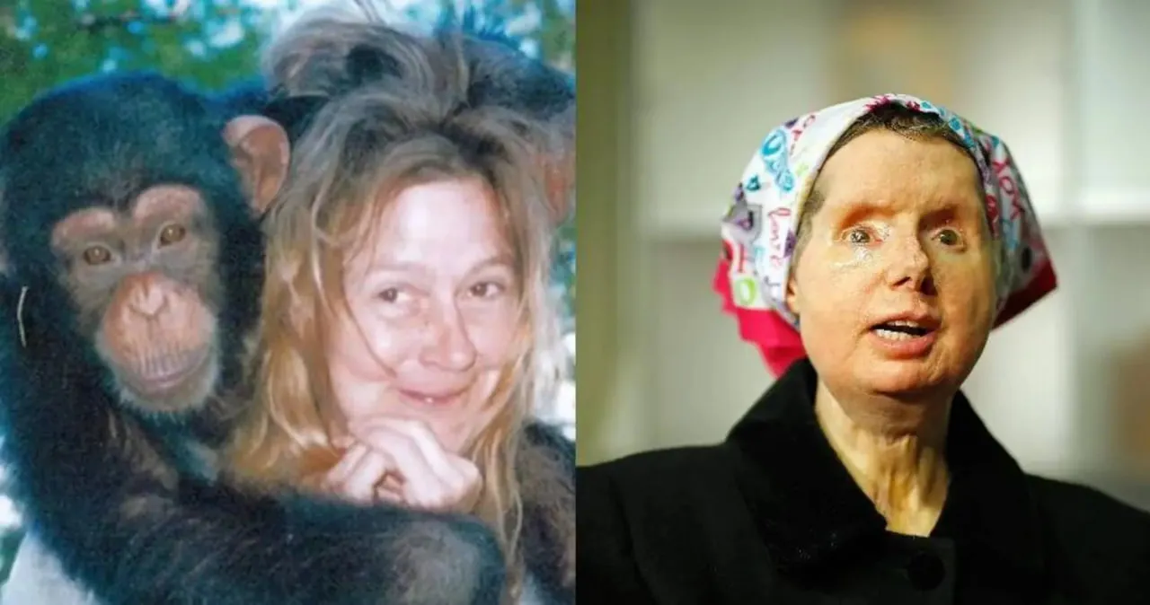 The sad story of Charla Nash, the woman whose face was ripped off by an chimpanzee