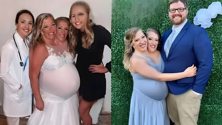 The Woman Who Was Born With 2 Heads Finally Gave Birth, Wait Till You See What She Gave Birth To
