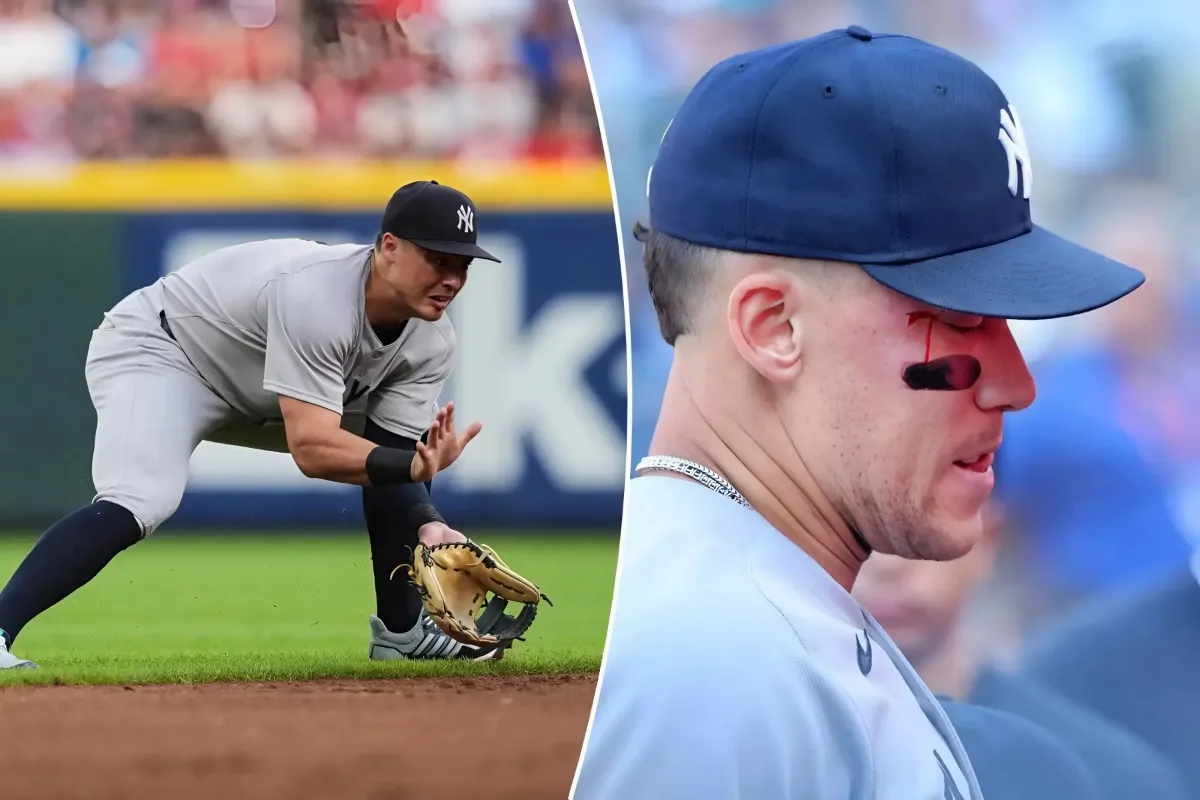 Aaron Judge Bloodied in Yankees' Chaos: Struck by Anthony Volpe's Throw in Dramatic Intermission! - lulu