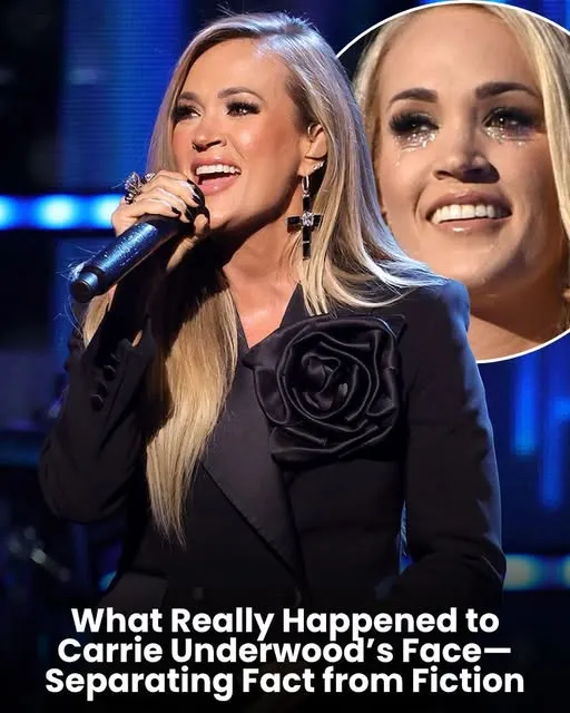 What Really Happened to Carrie Underwood’s Face—Separating Fact from Fiction