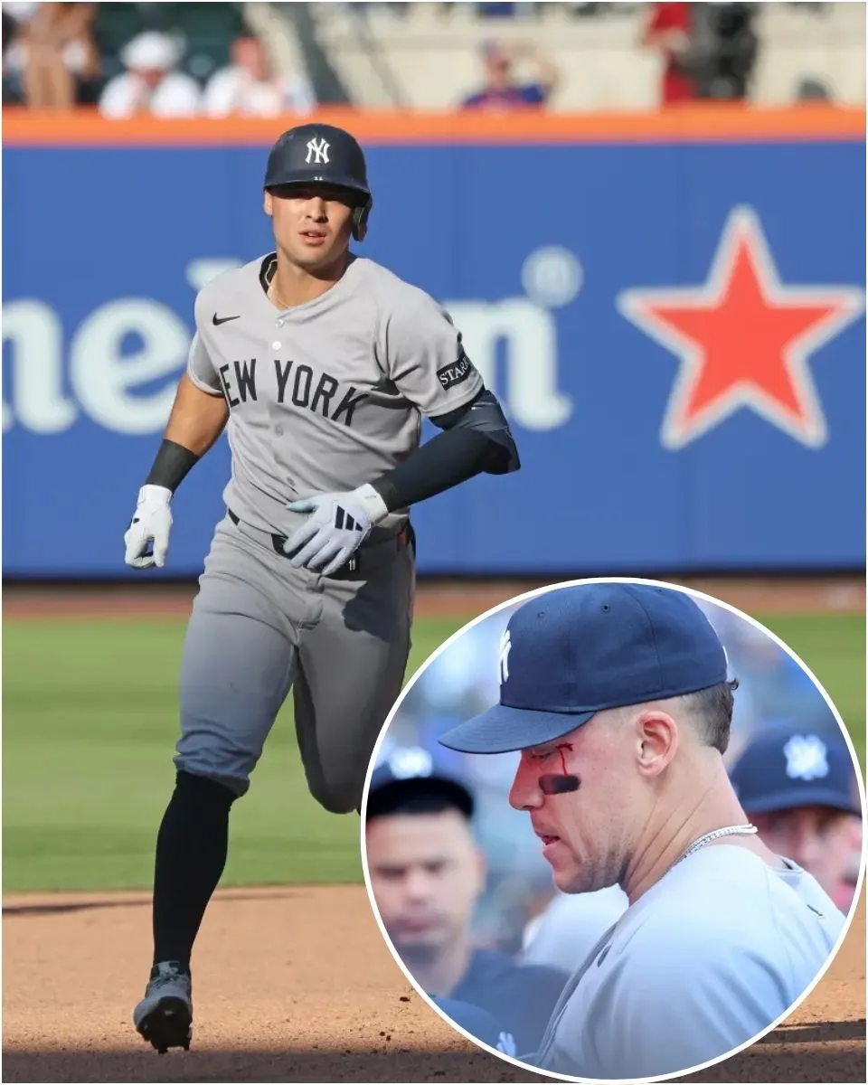 Aaron Judge bloodied after getting hit by Anthony Volpe throw between innings in wild Yankees moment