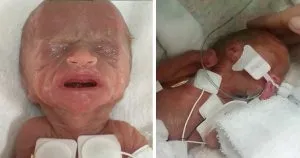 P2. Tru Beare’s Incredible Journey: From a 1-Pound Premature Birth to a Thriving Toddler P2. Tru Beare’s Incredible Journey: From a 1-Pound Premature Birth to a Thriving Toddler
