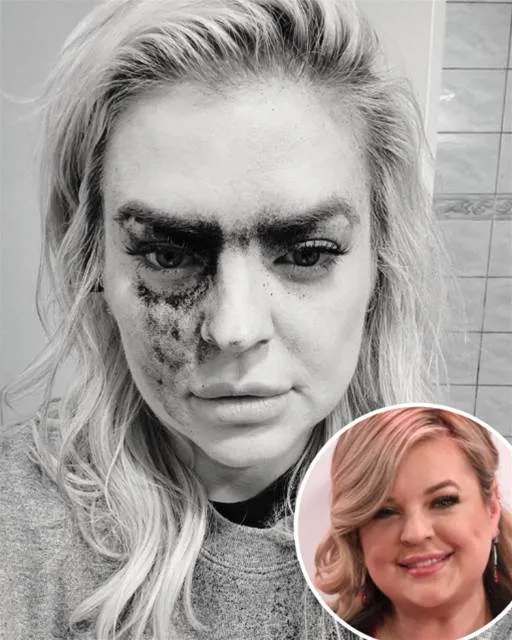 Shocking Health Update: Kirsten Storms’ GH Future in Doubt After Serious Complications