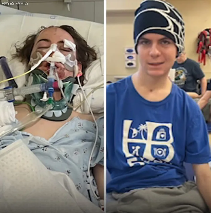 Huntington Beach teenager makes miracle recovery after being hit by car